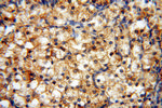 AK2 Antibody in Immunohistochemistry (Paraffin) (IHC (P))
