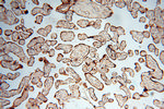 AK2 Antibody in Immunohistochemistry (Paraffin) (IHC (P))