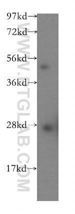 AK2 Antibody in Western Blot (WB)