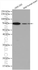 PGM2 Antibody in Western Blot (WB)