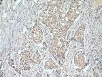 ACTR1B Antibody in Immunohistochemistry (Paraffin) (IHC (P))