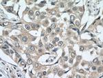 ACTR1B Antibody in Immunohistochemistry (Paraffin) (IHC (P))