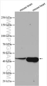 ACTR1B Antibody in Western Blot (WB)