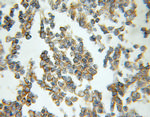 RAB33A Antibody in Immunohistochemistry (Paraffin) (IHC (P))