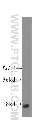 RAB33A Antibody in Western Blot (WB)