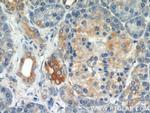 PLOD3 Antibody in Immunohistochemistry (Paraffin) (IHC (P))