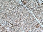 PLOD3 Antibody in Immunohistochemistry (Paraffin) (IHC (P))