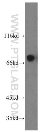 PLOD3 Antibody in Western Blot (WB)