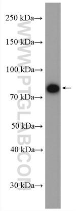 PLOD3 Antibody in Western Blot (WB)