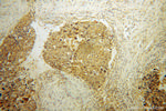 FHL3 Antibody in Immunohistochemistry (Paraffin) (IHC (P))
