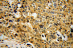 FHL3 Antibody in Immunohistochemistry (Paraffin) (IHC (P))