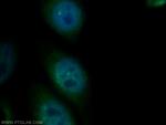PSMB4 Antibody in Immunocytochemistry (ICC/IF)