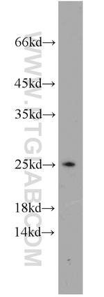 PSMB4 Antibody in Western Blot (WB)