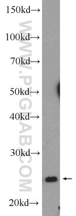 PSMB4 Antibody in Western Blot (WB)