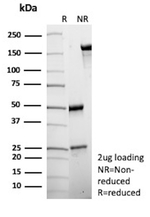 Choline Acetyltransferase (CHAT) (Marker of Cholinergic Cells) Antibody in SDS-PAGE (SDS-PAGE)