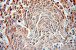 FEM1B Antibody in Immunohistochemistry (Paraffin) (IHC (P))