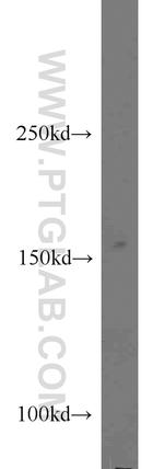 CPSF1 Antibody in Western Blot (WB)