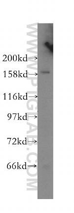 CPSF1 Antibody in Western Blot (WB)
