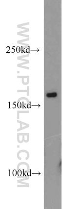 CPSF1 Antibody in Western Blot (WB)
