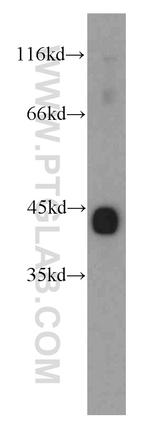 Alpha cardiac muscle actin Antibody in Western Blot (WB)