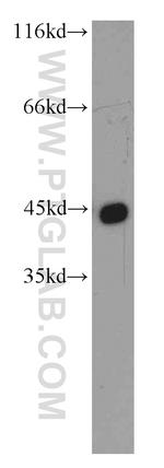 Alpha cardiac muscle actin Antibody in Western Blot (WB)