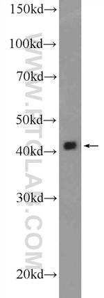 Alpha cardiac muscle actin Antibody in Western Blot (WB)