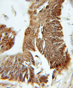 PFDN1 Antibody in Immunohistochemistry (Paraffin) (IHC (P))