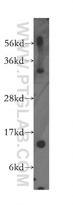 PFDN1 Antibody in Western Blot (WB)