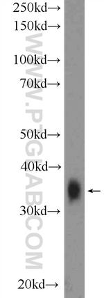 EIF2B2 Antibody in Western Blot (WB)