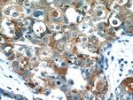 TPM2 Antibody in Immunohistochemistry (Paraffin) (IHC (P))