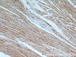 TPM2 Antibody in Immunohistochemistry (Paraffin) (IHC (P))