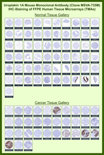 Uroplakin 1A (Urothelial Differentiation Marker) Monoclonal Antibody (MSVA-735M)