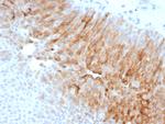 Uroplakin 1A (Urothelial Differentiation Marker) Recombinant Rabbit Monoclonal Antibody (UPK1A/8704R)