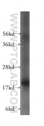 UXT Antibody in Western Blot (WB)