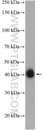 KRT33B Antibody in Western Blot (WB)