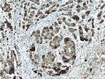 KRT33B Antibody in Immunohistochemistry (Paraffin) (IHC (P))