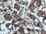 KRT33B Antibody in Immunohistochemistry (Paraffin) (IHC (P))
