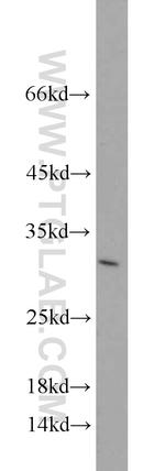 GAS41 Antibody in Western Blot (WB)