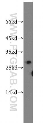 GAS41 Antibody in Western Blot (WB)