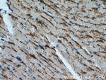 Cathepsin F Antibody in Immunohistochemistry (Paraffin) (IHC (P))