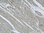 Cathepsin F Antibody in Immunohistochemistry (Paraffin) (IHC (P))