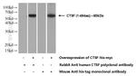 Cathepsin F Antibody in Western Blot (WB)