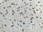 Cirhin Antibody in Immunohistochemistry (Paraffin) (IHC (P))