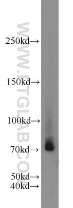Cirhin Antibody in Western Blot (WB)