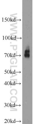 Cirhin Antibody in Western Blot (WB)