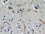 IL13RA2 Antibody in Immunohistochemistry (Paraffin) (IHC (P))