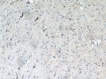 IL13RA2 Antibody in Immunohistochemistry (Paraffin) (IHC (P))