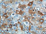 IL13RA2 Antibody in Immunohistochemistry (Paraffin) (IHC (P))