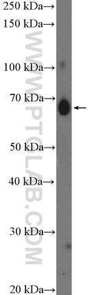 IL13RA2 Antibody in Western Blot (WB)