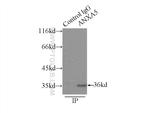 Annexin V Antibody in Immunoprecipitation (IP)